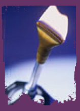 Bunsen burner